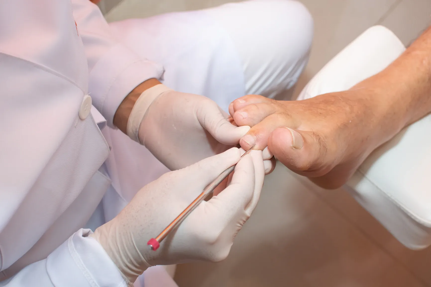 Podóloga de jaleco e luvas cuidando das unhas do pé de um paciente em atendimento preventivo